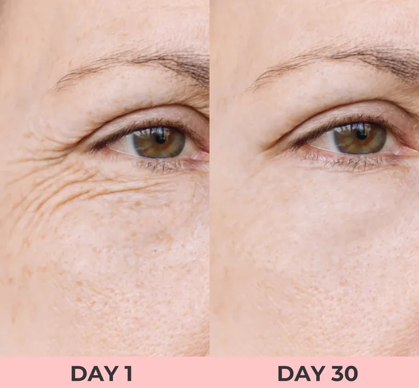 صورة النتائج